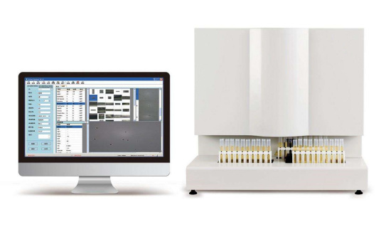 尿沉渣分析仪