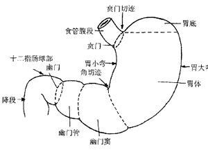 胃食管反流症状