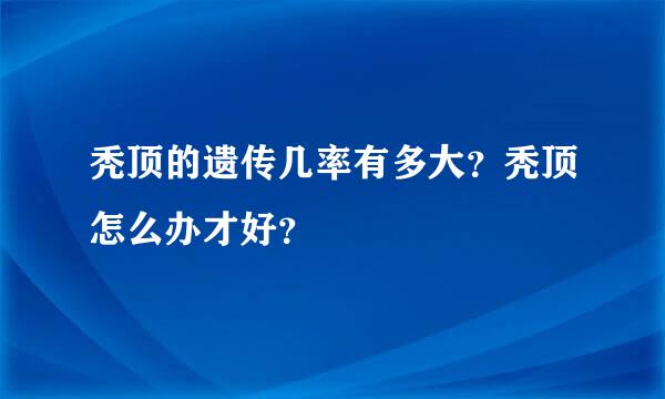 秃顶的遗传几率有多大？秃顶怎么办才好？