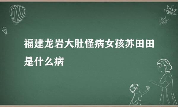 福建龙岩大肚怪病女孩苏田田是什么病