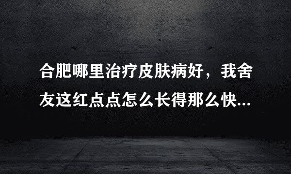 合肥哪里治疗皮肤病好，我舍友这红点点怎么长得那么快，好吓人啊