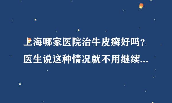 上海哪家医院治牛皮癣好吗？医生说这种情况就不用继续涂药勒以后还会在张长出了在涂