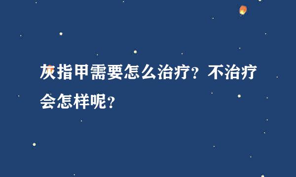 灰指甲需要怎么治疗？不治疗会怎样呢？