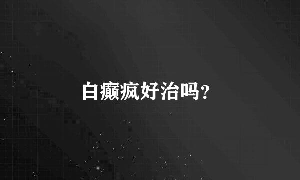 白癫疯好治吗？