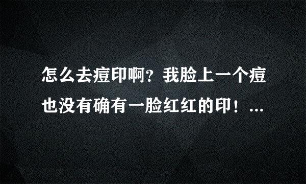 怎么去痘印啊？我脸上一个痘也没有确有一脸红红的印！怎么办？急！