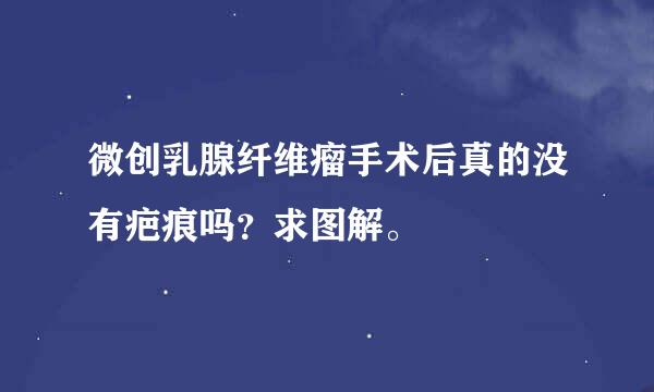 微创乳腺纤维瘤手术后真的没有疤痕吗？求图解。