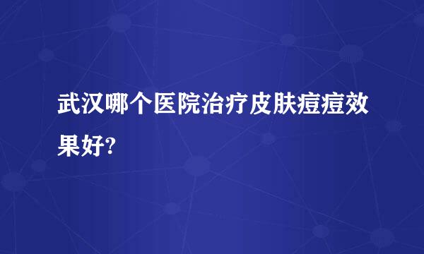 武汉哪个医院治疗皮肤痘痘效果好?