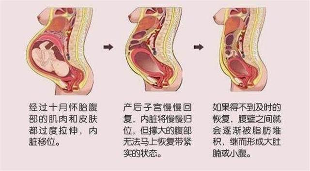 产后需要恢复多少时间