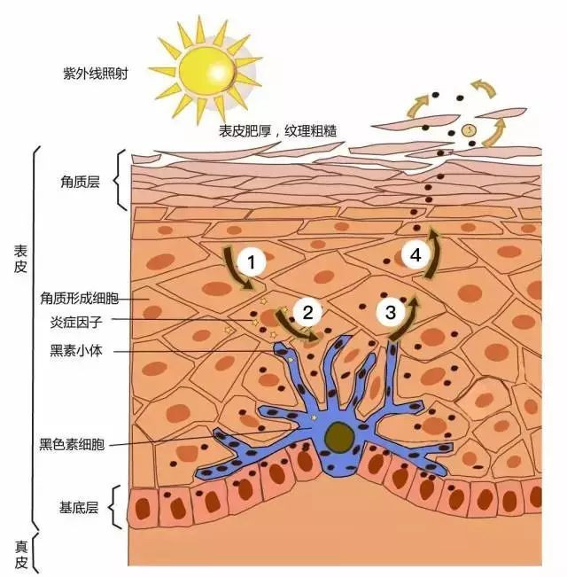 脸上有白斑怎么治疗？