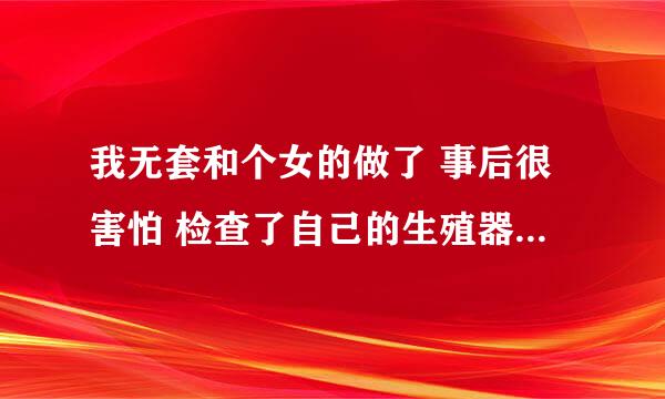 我无套和个女的做了 事后很害怕 检查了自己的生殖器没有破损 现在很担心得艾滋病 就发生了一次关系