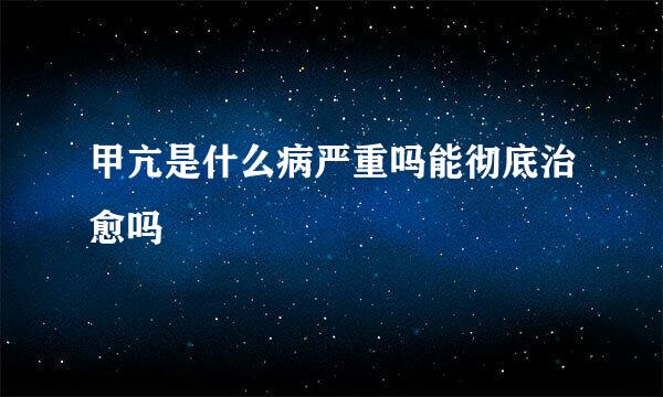 甲亢是什么病严重吗能彻底治愈吗