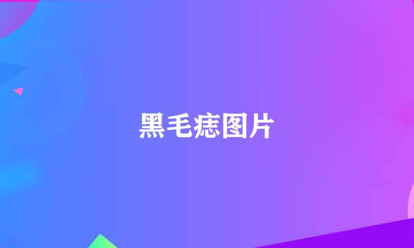 黑毛痣图片