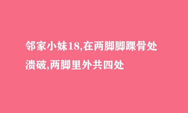 邻家小妹18,在两脚脚踝骨处溃破,两脚里外共四处