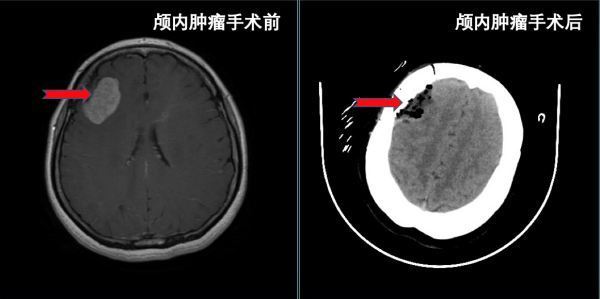 神经内科主要看什么病