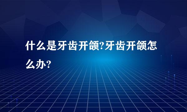 什么是牙齿开颌?牙齿开颌怎么办?