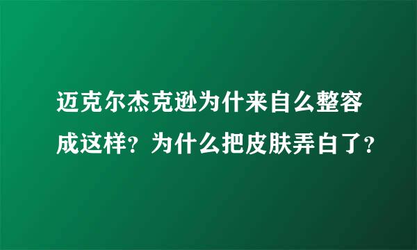 迈克尔杰克逊为什来自么整容成这样？为什么把皮肤弄白了？