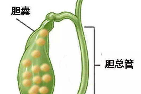 胆囊切除后有什么影响?