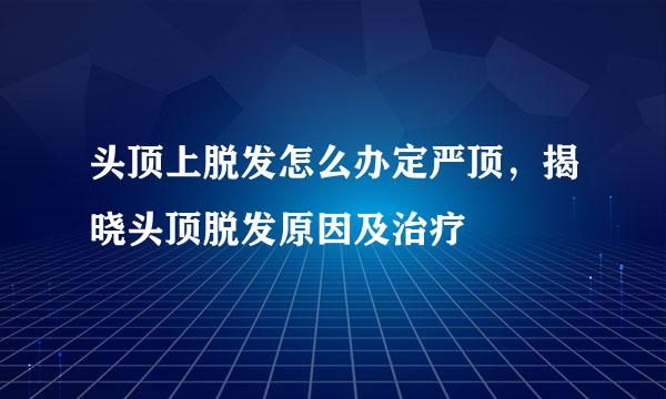 头顶上脱发怎么办定严顶，揭晓头顶脱发原因及治疗