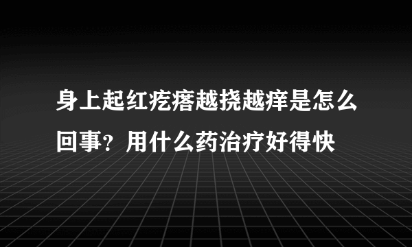 身上起红疙瘩越挠越痒是怎么回事？用什么药治疗好得快