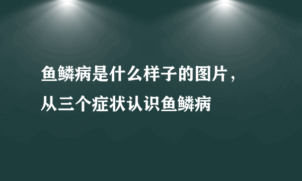 鱼鳞病是什么样子的图片， 从三个症状认识鱼鳞病