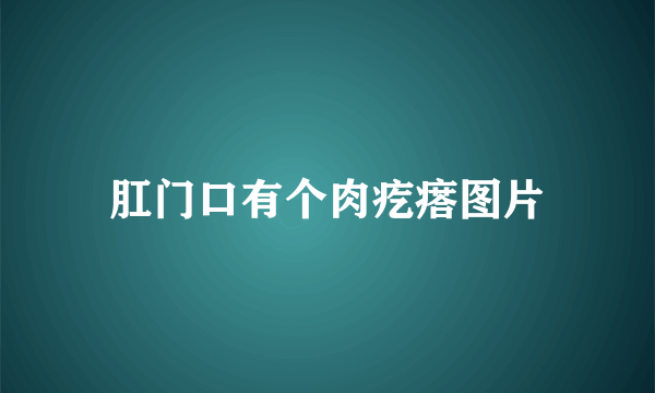 肛门口有个肉疙瘩图片