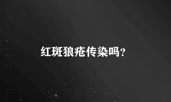 红斑狼疮传染吗？