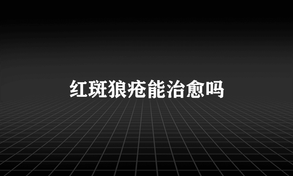 红斑狼疮能治愈吗