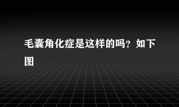 毛囊角化症是这样的吗？如下图