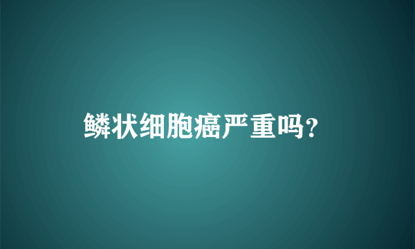 鳞状细胞癌严重吗？