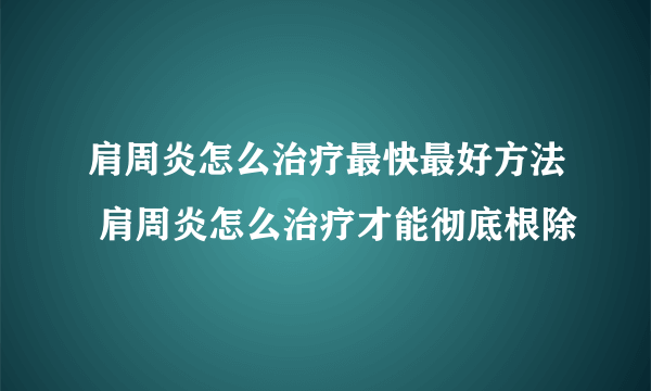 肩周炎怎么治疗最快最好方法 肩周炎怎么治疗才能彻底根除