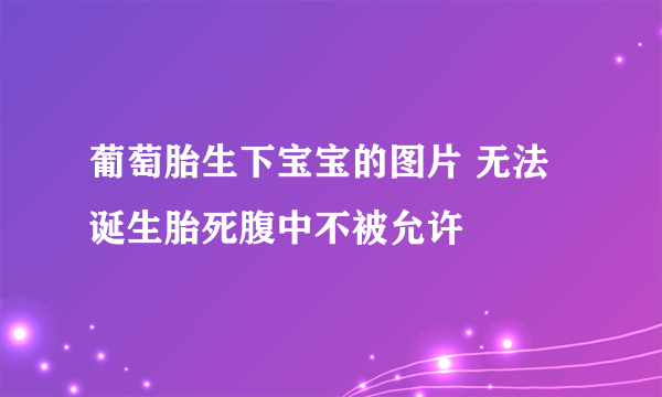 葡萄胎生下宝宝的图片 无法诞生胎死腹中不被允许