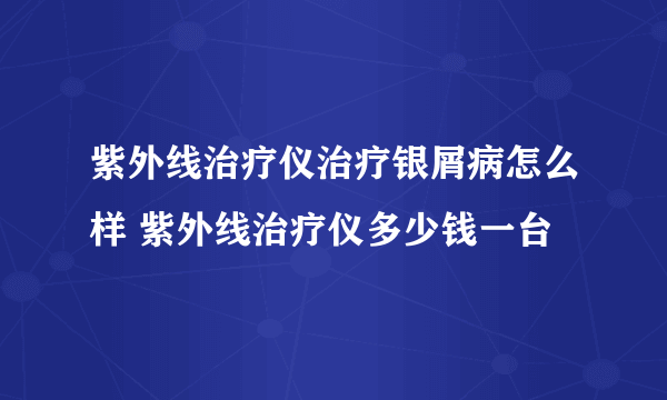 紫外线治疗仪治疗银屑病怎么样 紫外线治疗仪多少钱一台