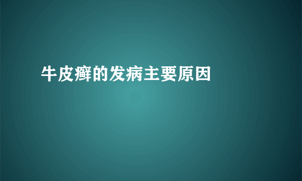 牛皮癣的发病主要原因	   