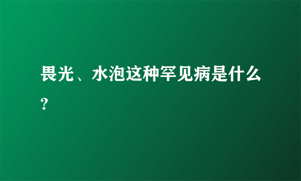 畏光、水泡这种罕见病是什么?