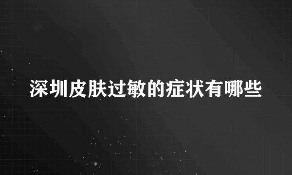 深圳皮肤过敏的症状有哪些