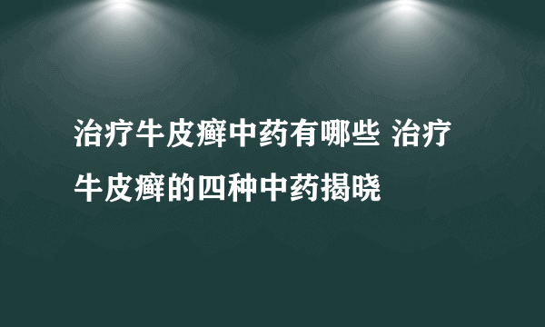 治疗牛皮癣中药有哪些 治疗牛皮癣的四种中药揭晓