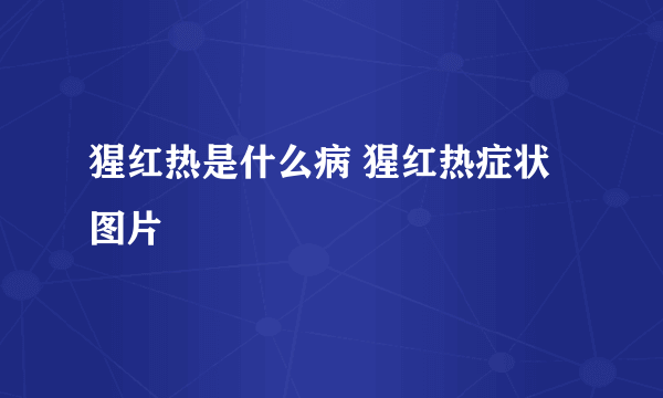 猩红热是什么病 猩红热症状图片