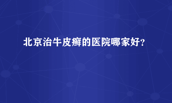 北京治牛皮癣的医院哪家好？