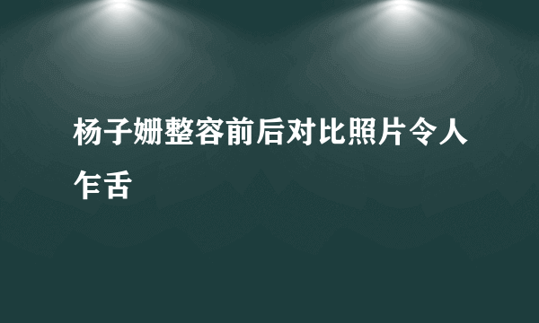 杨子姗整容前后对比照片令人乍舌