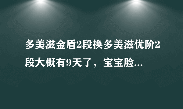 多美滋金盾2段换多美滋优阶2段大概有9天了，宝宝脸上一直出现湿疹怎么办？