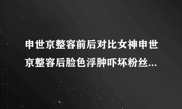 申世京整容前后对比女神申世京整容后脸色浮肿吓坏粉丝(2)_申世京整容前后_飞外网