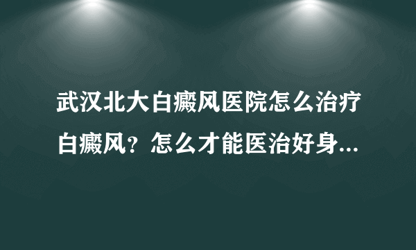 武汉北大白癜风医院怎么治疗白癜风？怎么才能医治好身上的白癜风呢?