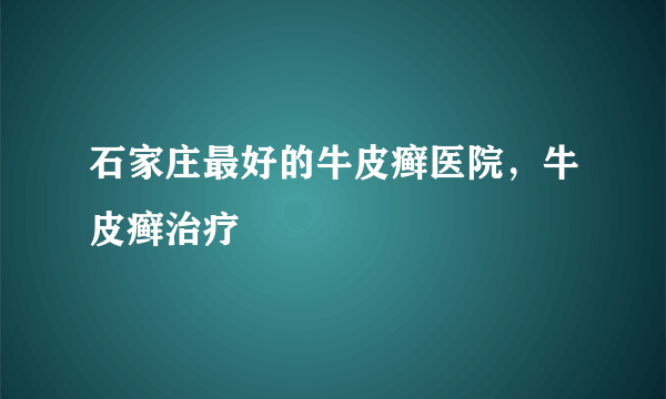 石家庄最好的牛皮癣医院，牛皮癣治疗