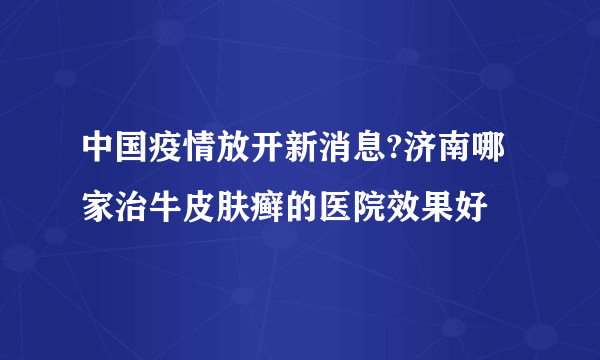 中国疫情放开新消息?济南哪家治牛皮肤癣的医院效果好