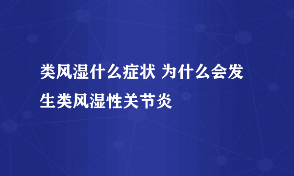 类风湿什么症状 为什么会发生类风湿性关节炎