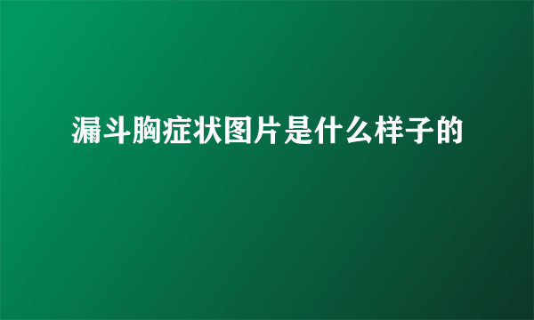 漏斗胸症状图片是什么样子的