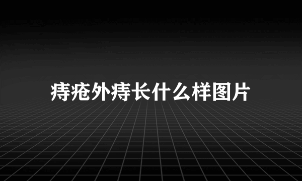 痔疮外痔长什么样图片