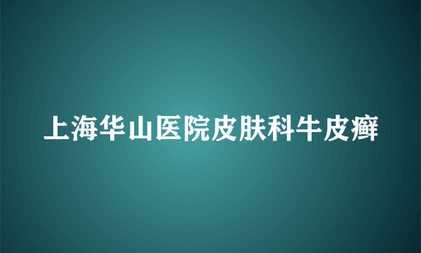 上海华山医院皮肤科牛皮癣