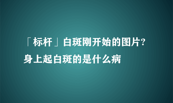 「标杆」白斑刚开始的图片?身上起白斑的是什么病