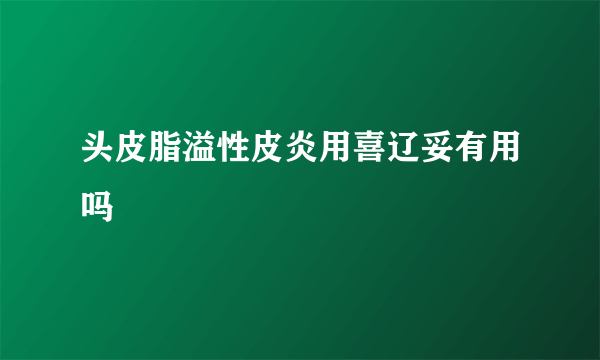 头皮脂溢性皮炎用喜辽妥有用吗